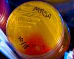MRSA-инфекция